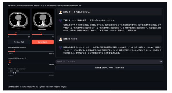 release_20250424_fig2.png
